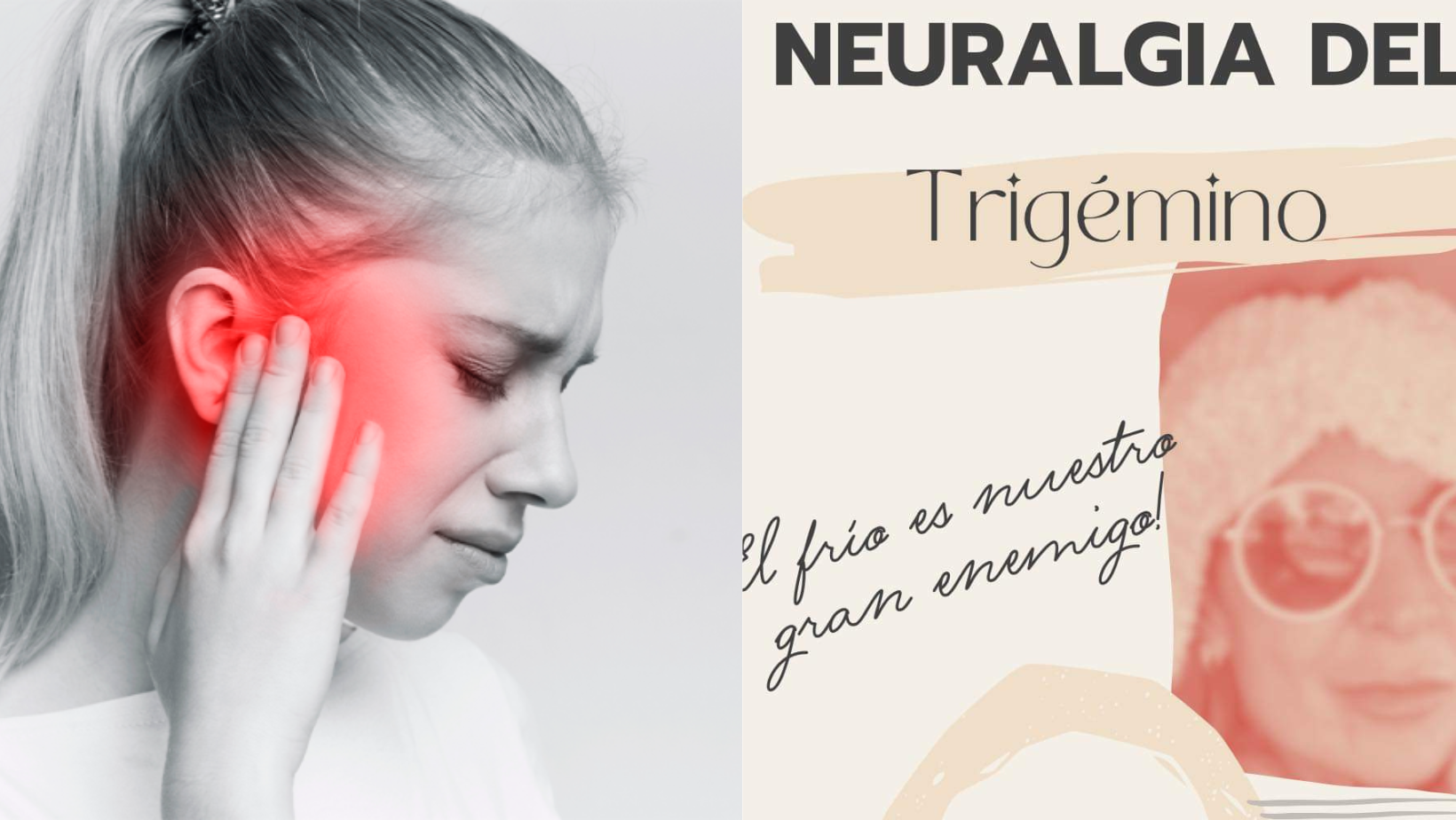 En este momento estás viendo ¿Qué es la neuralgia del trigémino y por qué causa un dolor insoportable en la cara?
