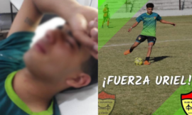 Un jugador recibió una patada en la cara y producto del golpe le quebraron la mandíbula