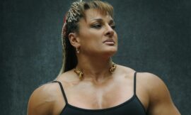 El neurocirujano que operó a Alejandra Oliveras, la “Locomotora”, explicó el motivo del ACV isquémico