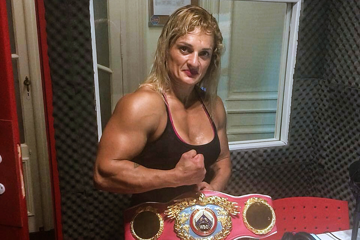 En este momento estás viendo El hermano de Alejandra “Locomotora” Oliveras advirtió que puede quedar hemipléjica por el ACV