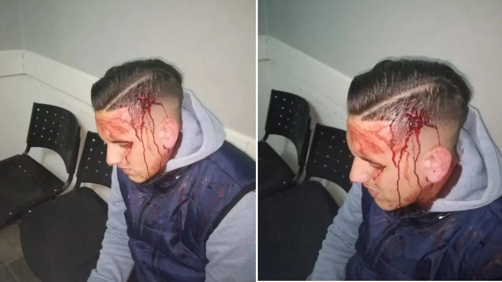 En este momento estás viendo Brutal agresión: un joven denuncia violento ataque de su expareja y el padre de ella