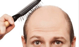 Día del Pelado: que tan efectivos son los tratamientos que prometen recuperar el cabello perdido