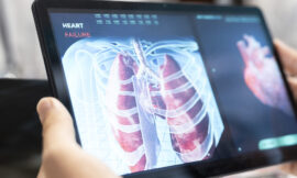 Espirometría: el estudio clave para detectar enfermedades pulmonares a tiempo y por qué los fumadores deberían controlarse